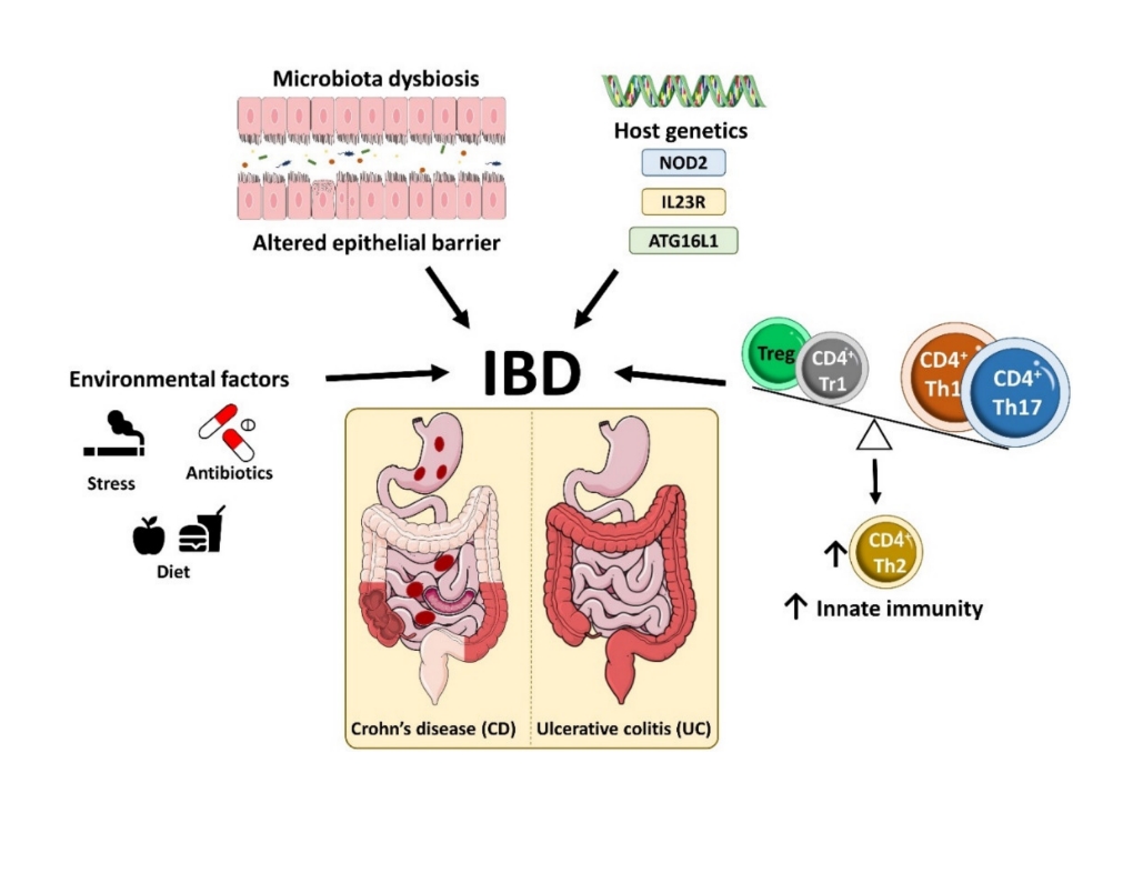 Come curare la malattia infiammatoria cronica intestinale in maniera integrata